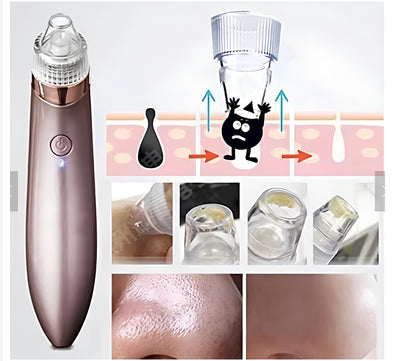 Extractor De Puntos Negros Y Espinillas